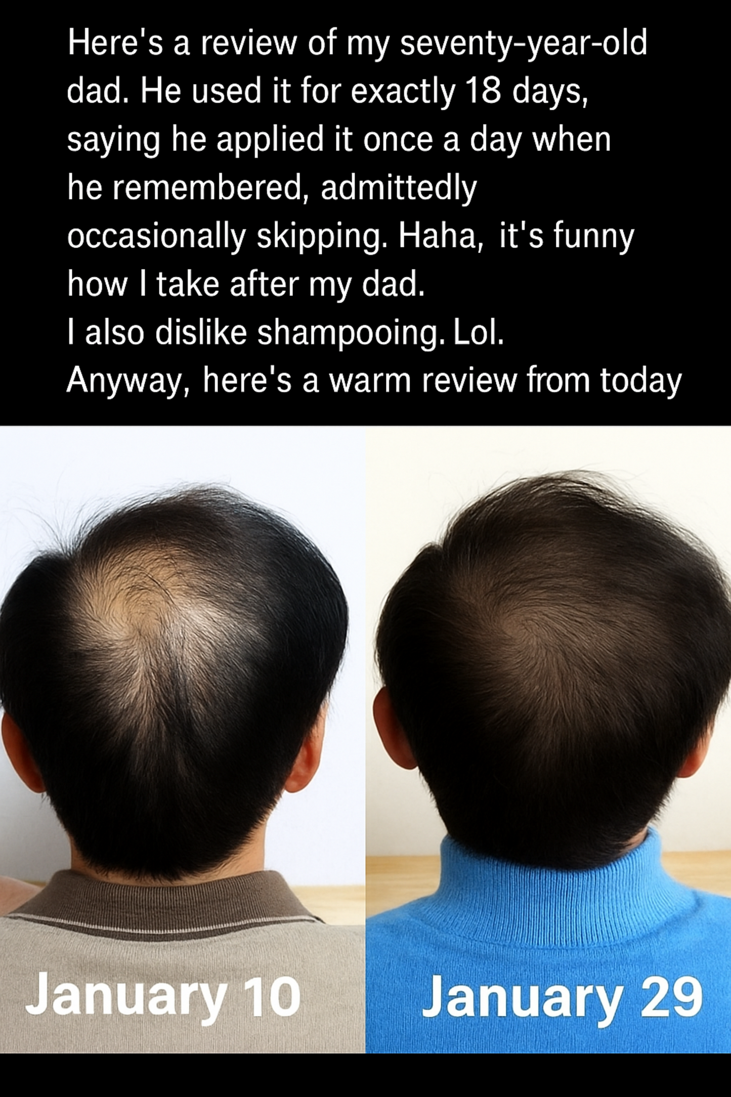 Deflanta shampoo