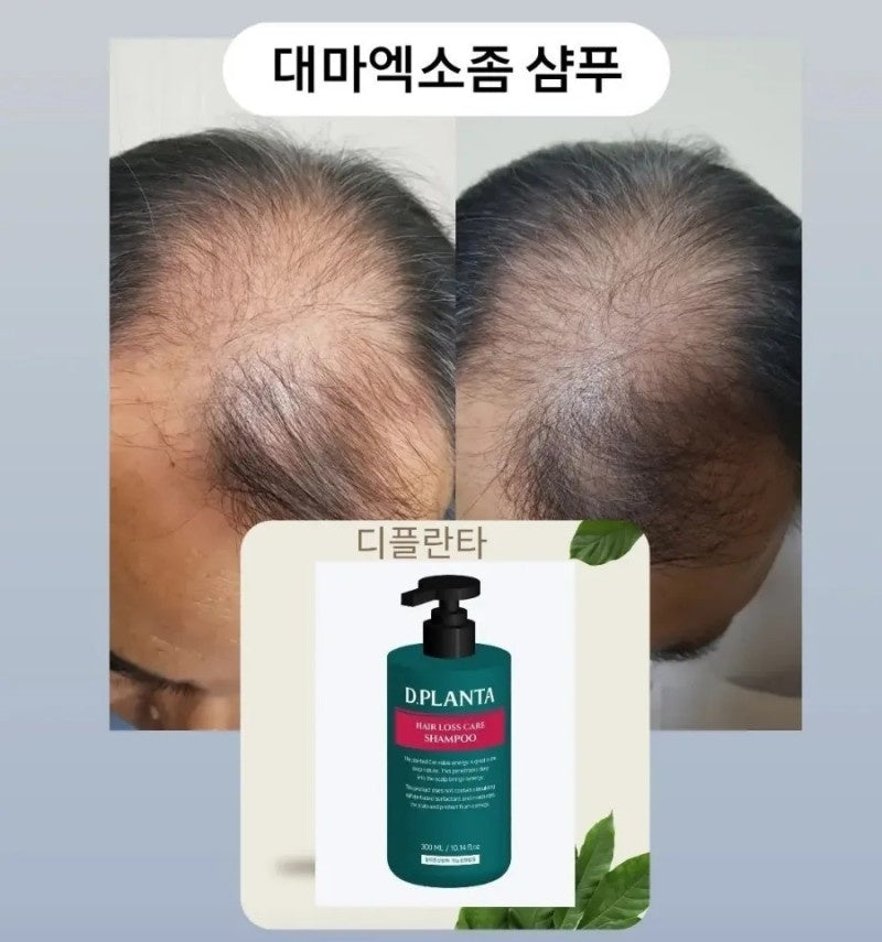 Deflanta shampoo
